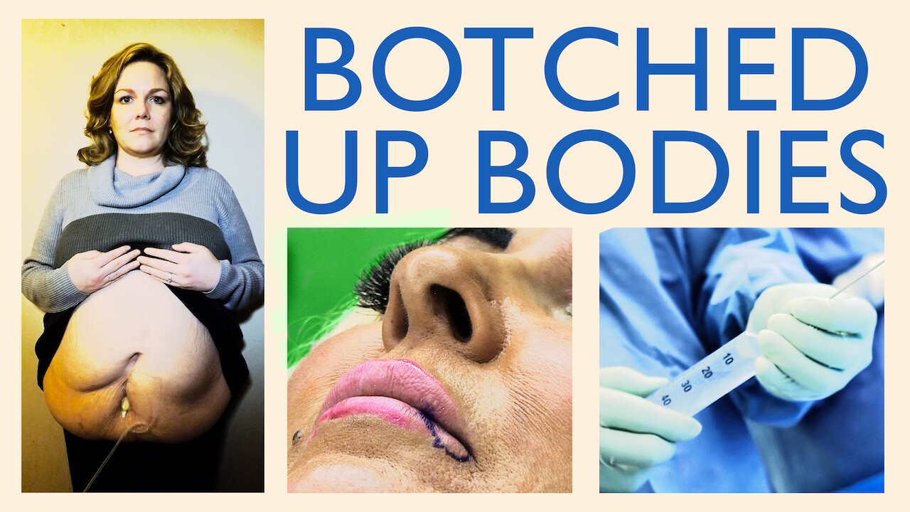 Is Botched Up Bodies on Netflix Where to Watch the Documentary